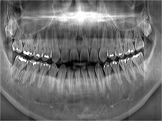 DentalPano