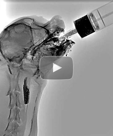 Contrast Fluoroscopic Study