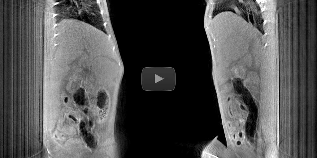 No need of a deep anesthesia and external lung ventilation setup