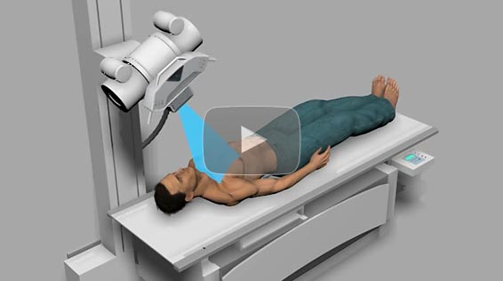 SUPPORTING ARC-TYPE MOTION TOMOSYNTHESIS