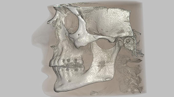 X-Ray system custom design, CBCT (cone beam computed tomography) system design and software, CBCT system trajectory registration (measurement), non-ideal andarbitrary system tarjectory support algorithms and software, X-Ray for equine , companion animal and veterinary applications, demo for download available